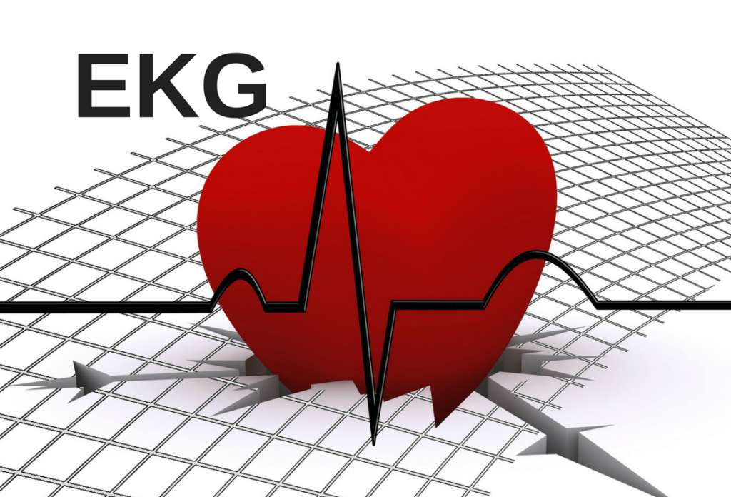 EKG